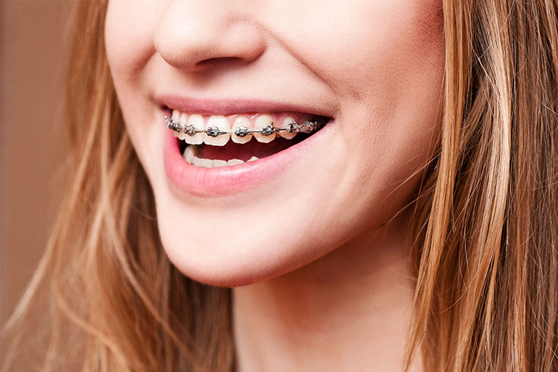 Orthodontics in Saddle Brook