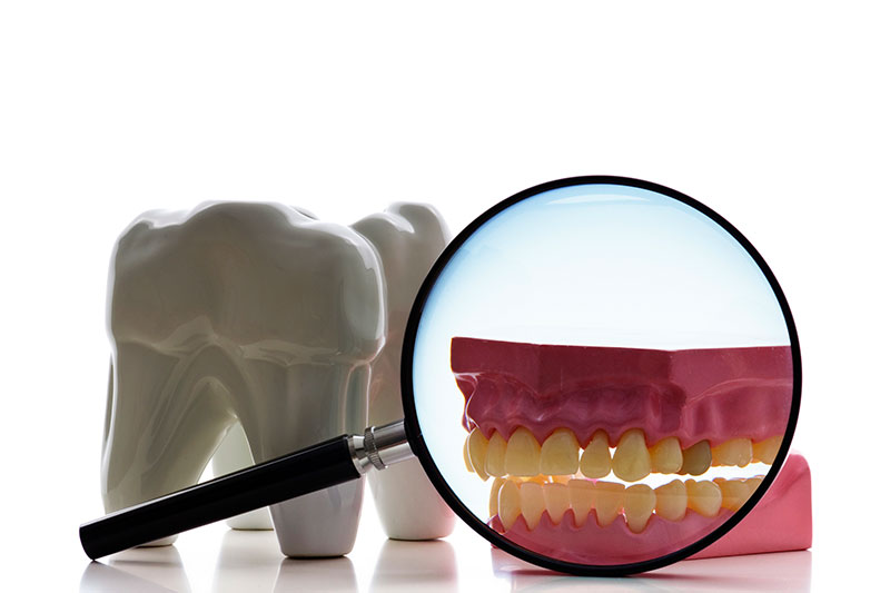 Root Canal in Saddle Brook